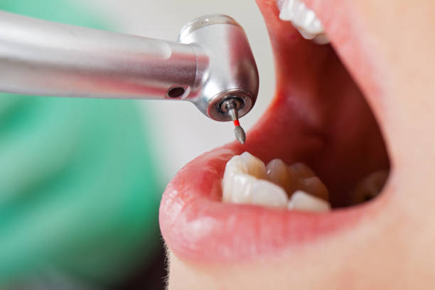 Best Emergency Tooth Extraction in Horseshoe Bend, AR